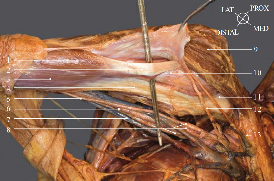 联合腱解剖图图片