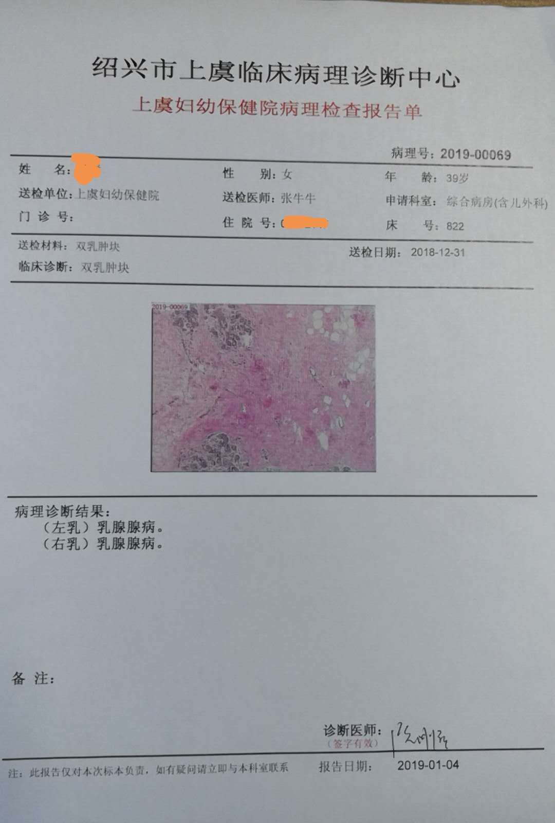 如果最终病理报告确诊为恶性,需要做第二次手术,行合适的乳腺癌根治术