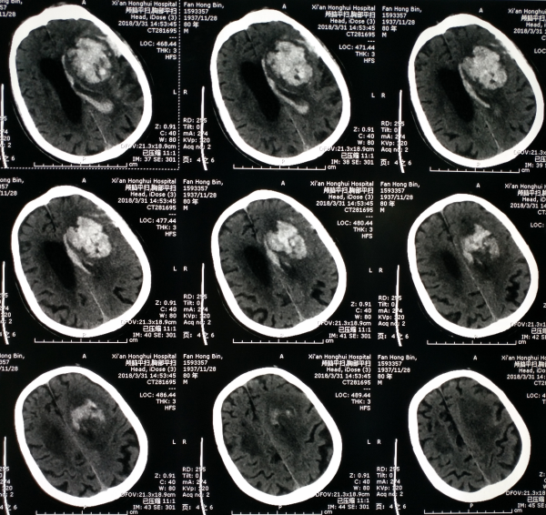 1547436713511108.png 2.png