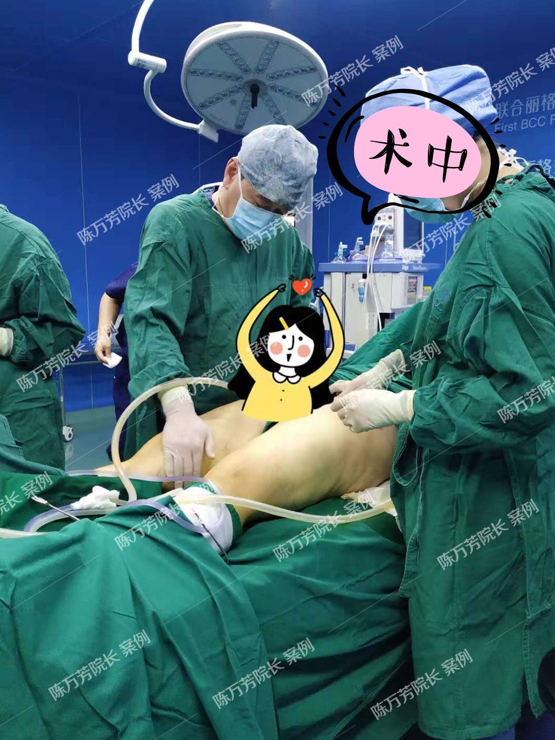 吸脂手术过程图图片