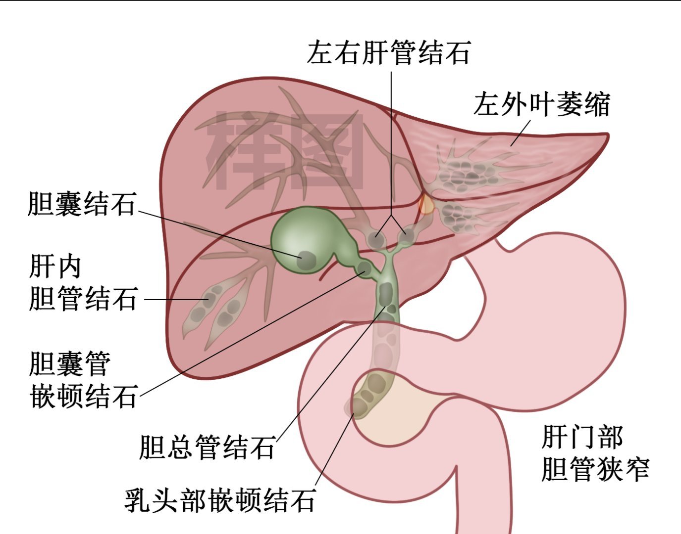 胆总管的位置图片图片