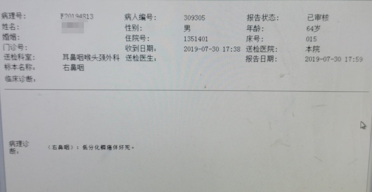 如果鼻咽癌放疗效果不满意,应尽早选择经鼻内镜下手术治疗_鼻咽癌