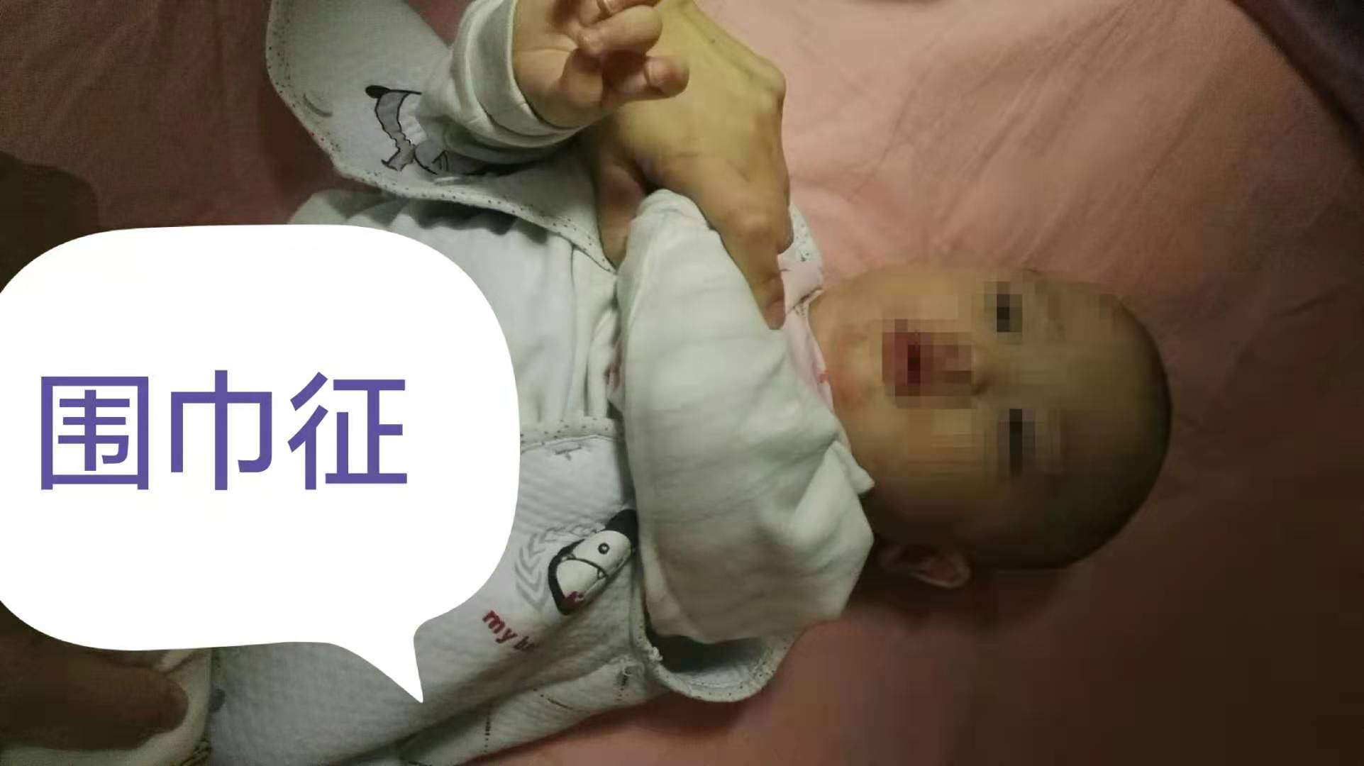 什么是肌张力,如何简单判断小孩肌张力高低?(附图片)(程明高)