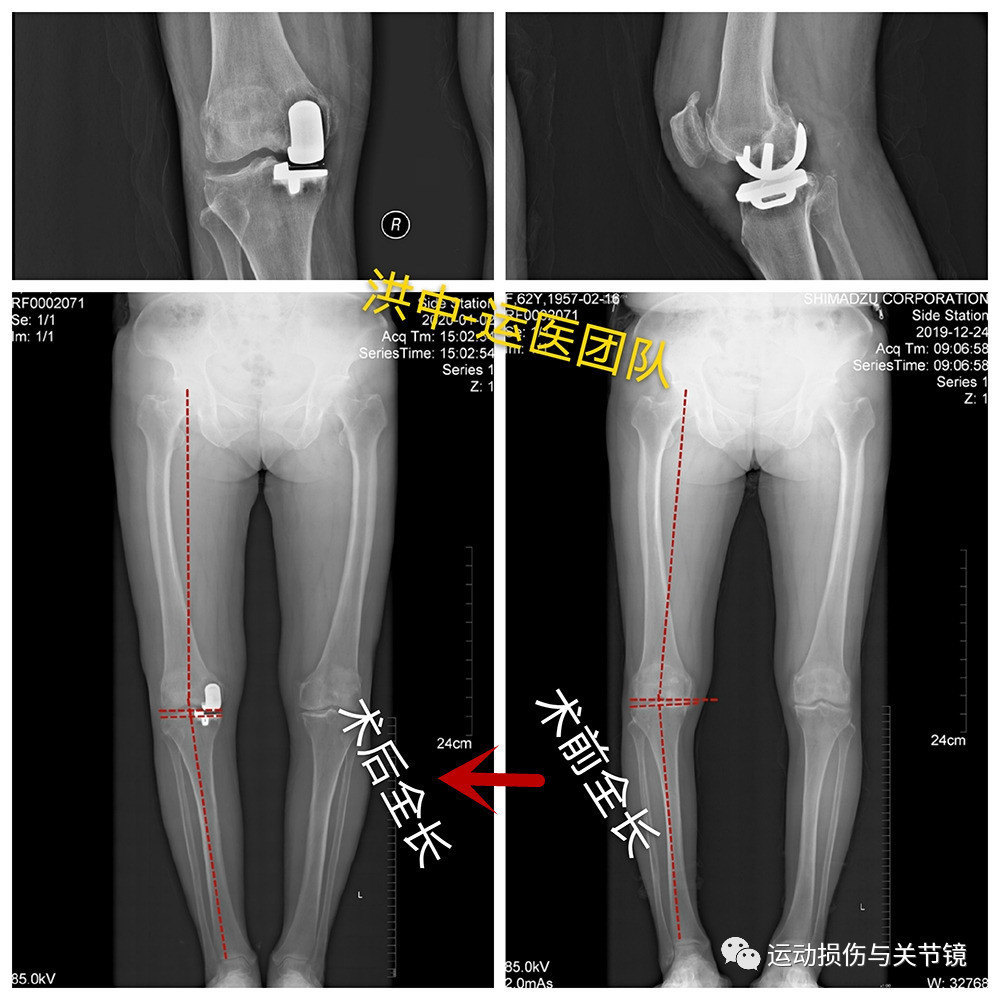 暂无
