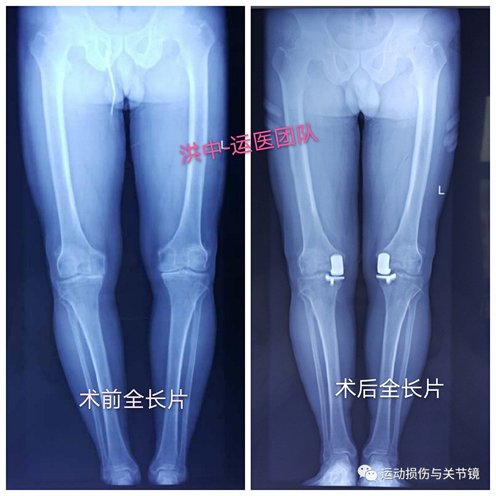 暂无