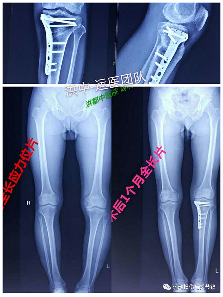 暂无
