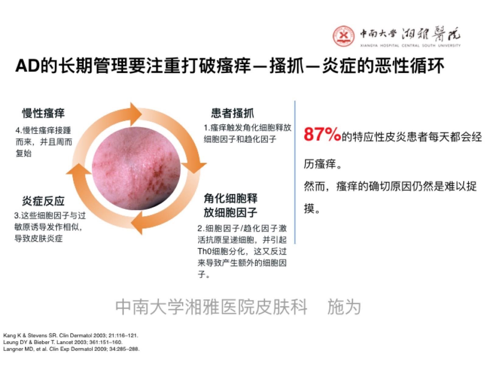 溼疹和特應性皮炎的外用藥物治療原則