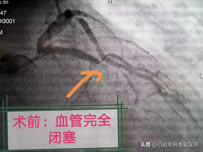 圖文圖片