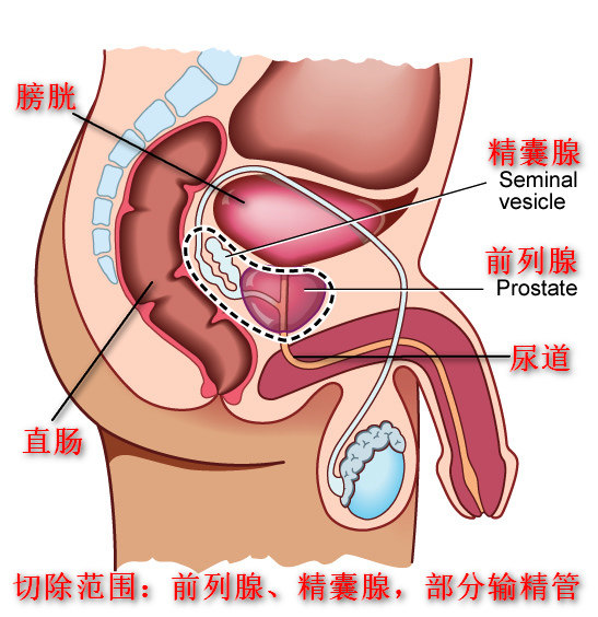 膀胱的具体位置图片图片