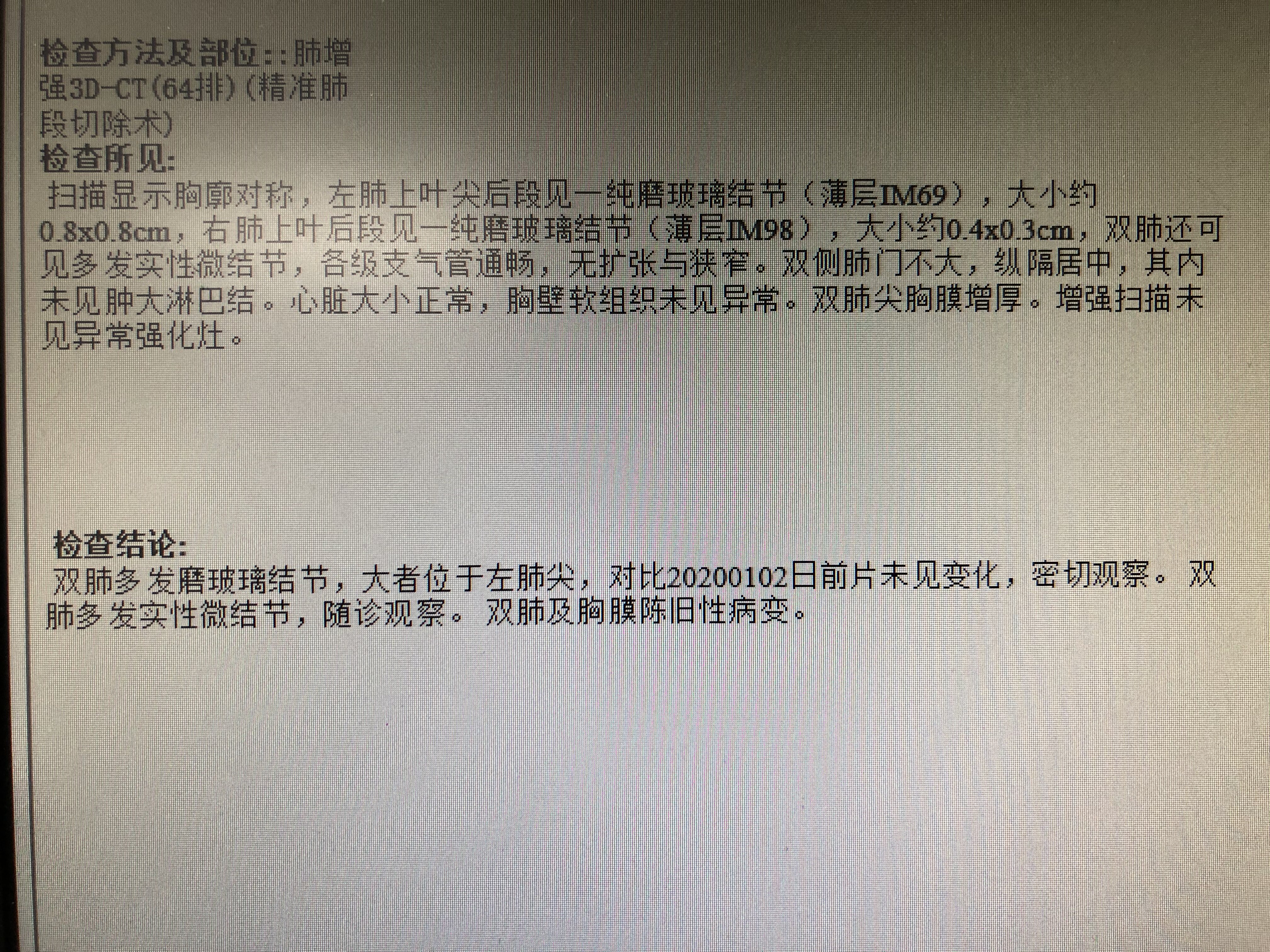 肺磨玻璃结节典型病例分享患者需要上传什么样的照片