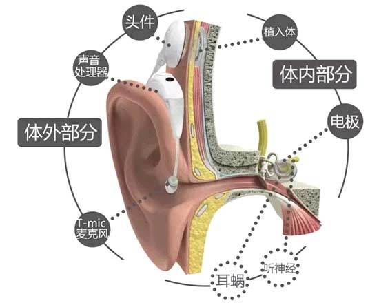 耳蜗的结构图解大全图片