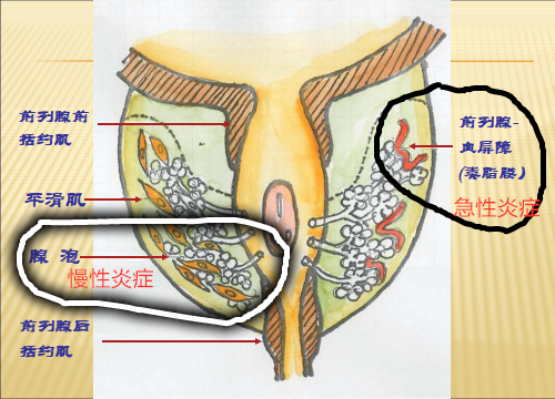 前庭大腺在哪里图片图片