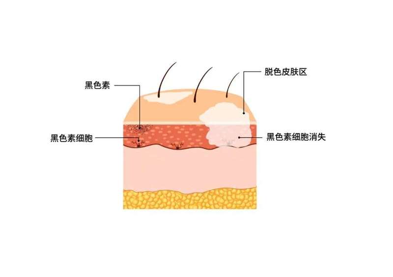 图文图片