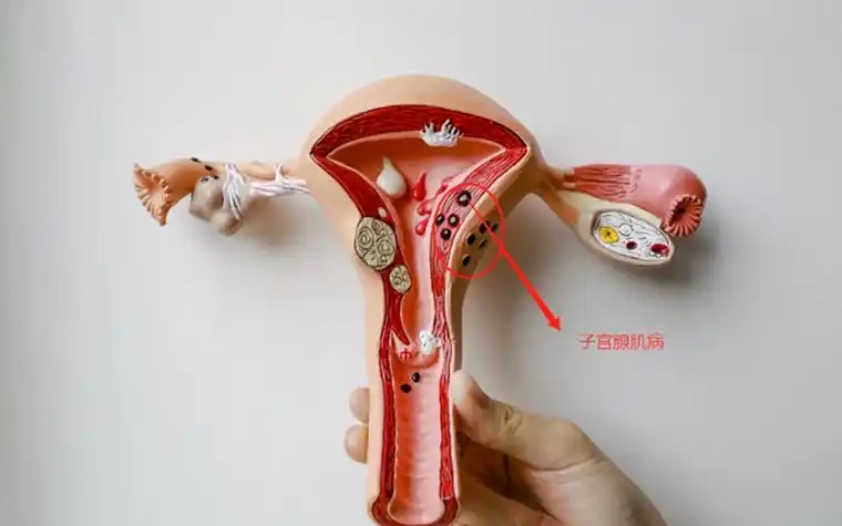 圖文圖片