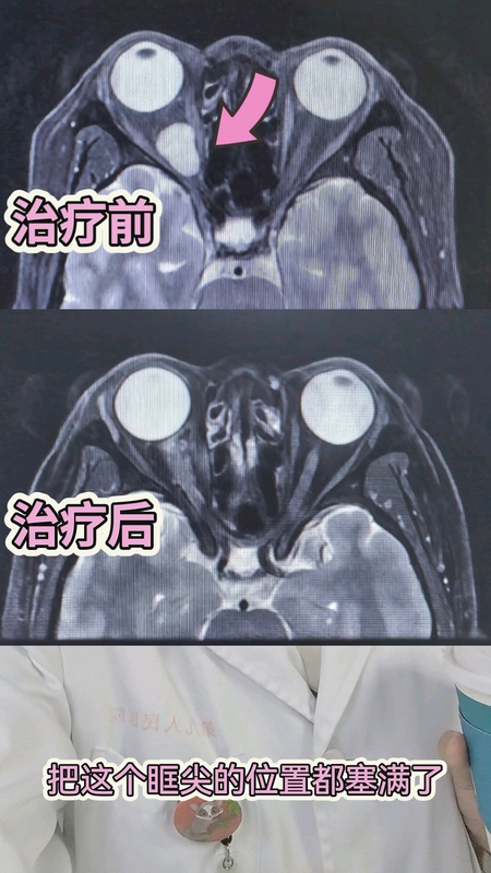 視頻封面