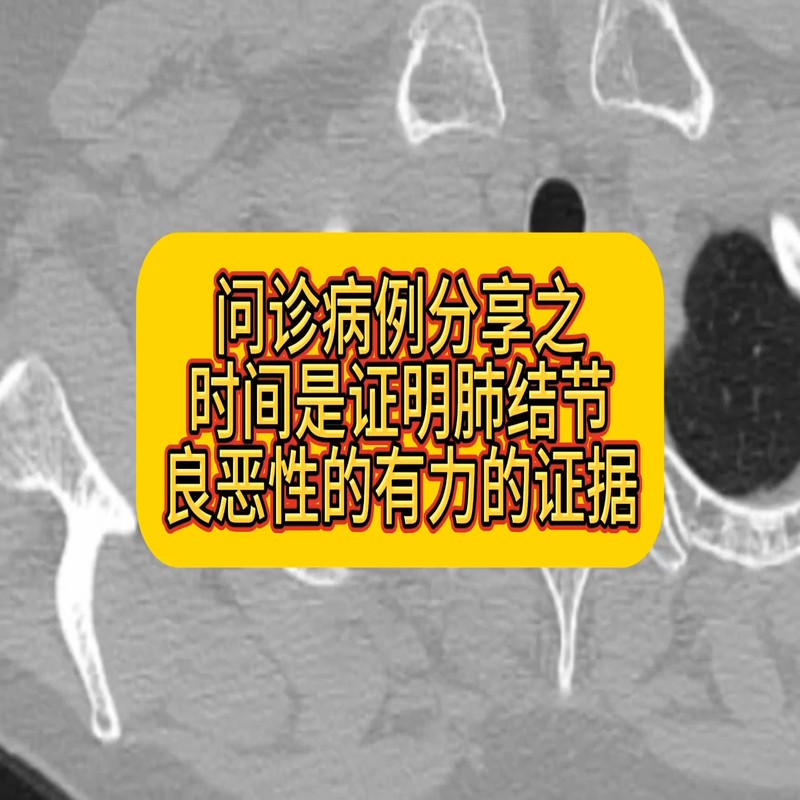 視頻封面