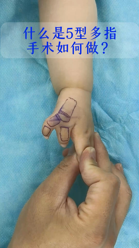 視頻封面