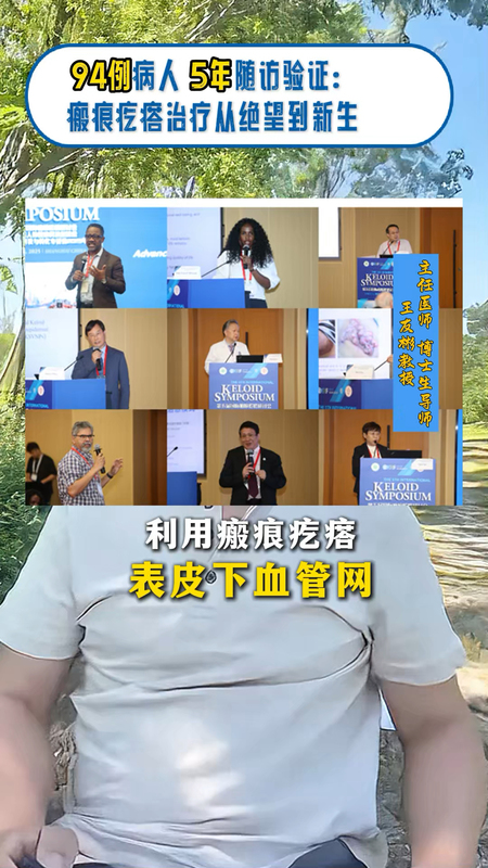 面部瘢痕疙瘩治疗-此核切非彼核切
