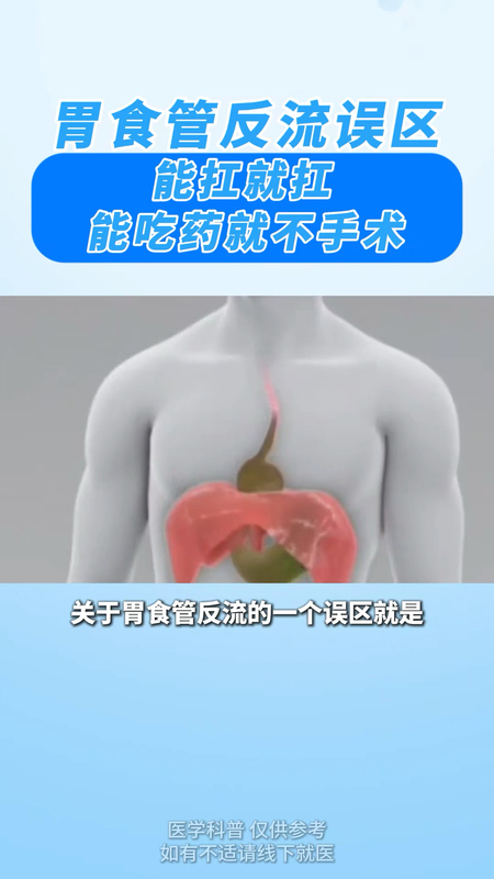 胃食管反流误区：能扛就扛！