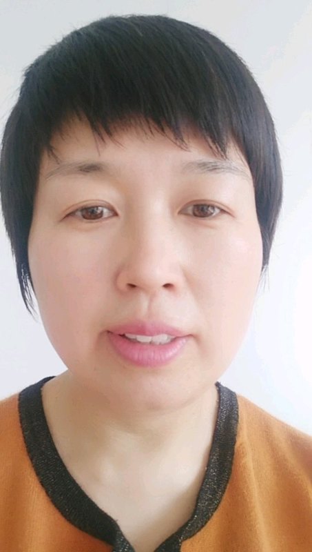 甲状腺功能五项当中的两个抗体升高往往是什么意思呢？