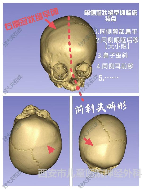 圖文圖片