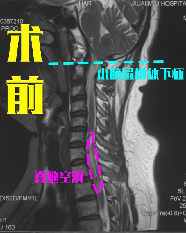 圖文圖片