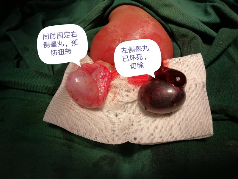 圖文圖片