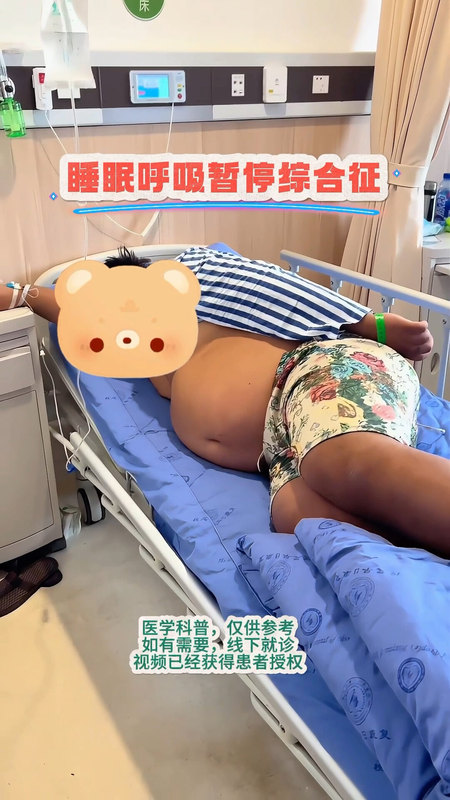 睡眠呼吸暂停综合征需要极度重视
