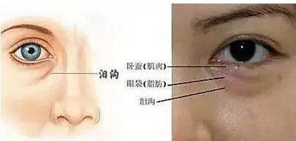 图文图片