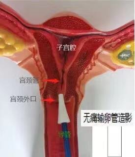 圖文圖片