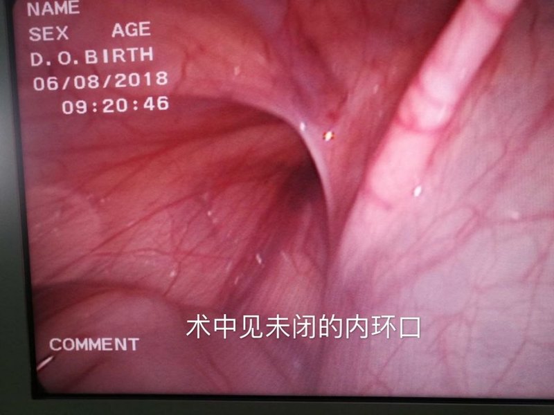 圖文圖片
