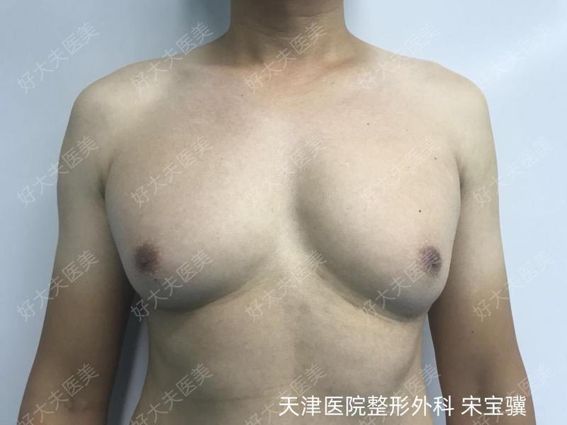 圖文圖片