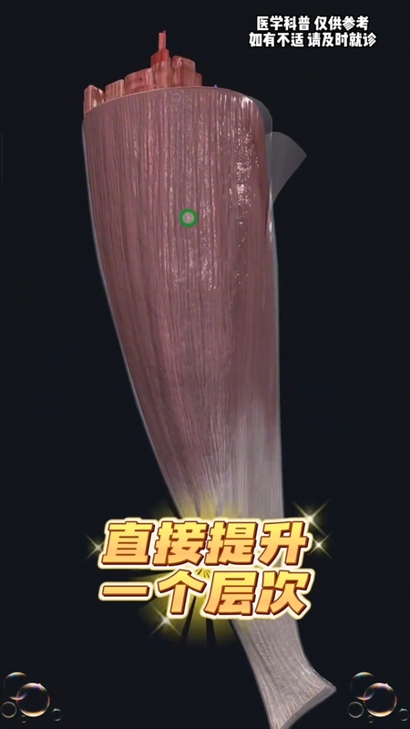 筋膜炎科普