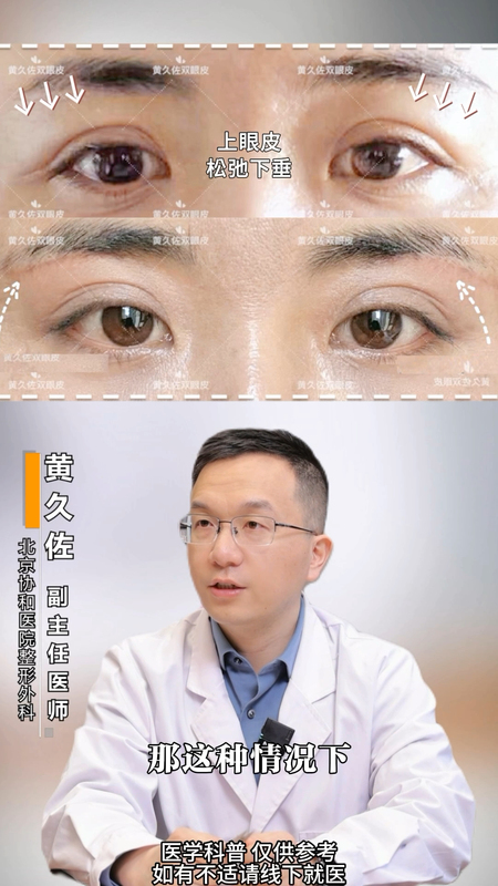 【切眉还是双眼皮】上眼皮松弛怎么选择最佳改变方案？