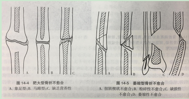 圖文圖片