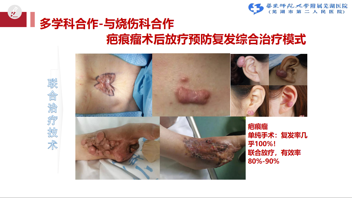 圖文圖片
