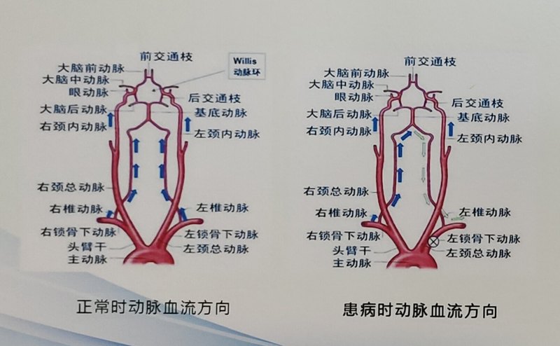圖文圖片