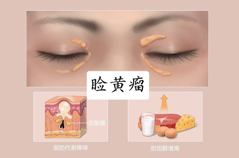 圖文圖片
