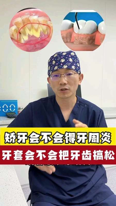 矫牙会不会得牙周病，会不会把牙齿搞松动