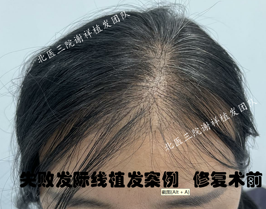 圖文圖片