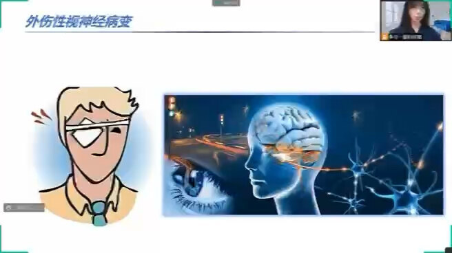 外伤后视神经损伤怎么办？