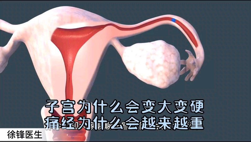 子宫为什么会变大变硬？痛经为什么会越来越痛