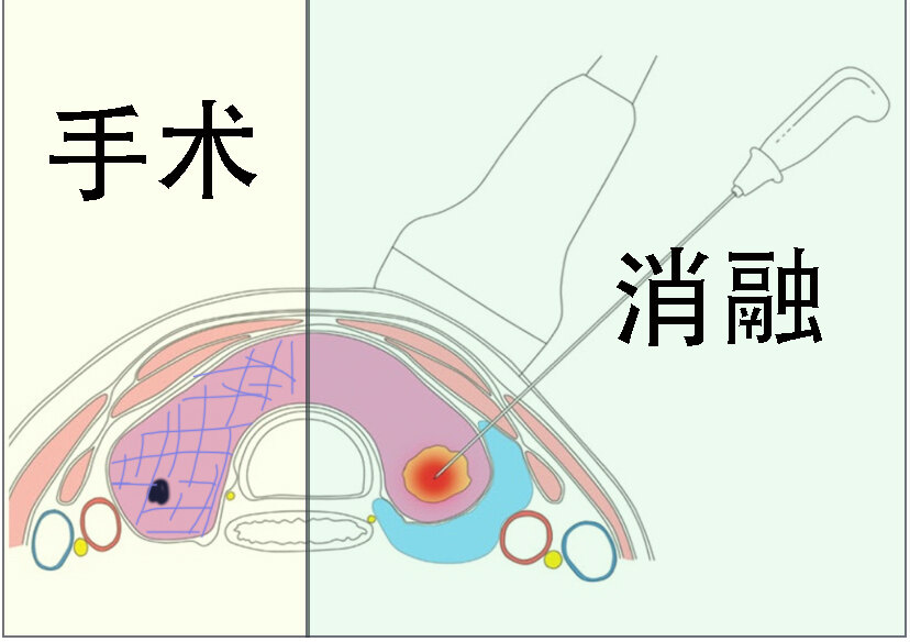 圖文圖片