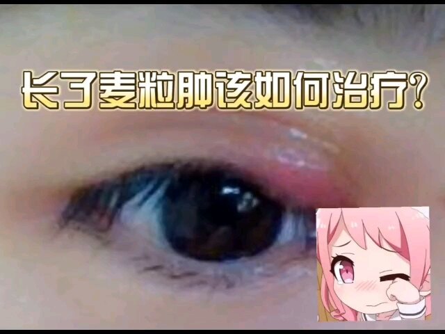 視頻封面