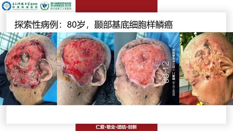 圖文圖片