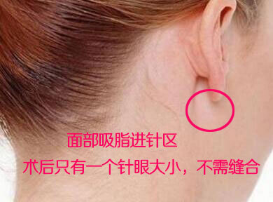 圖文圖片