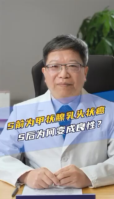 甲状腺乳头状癌