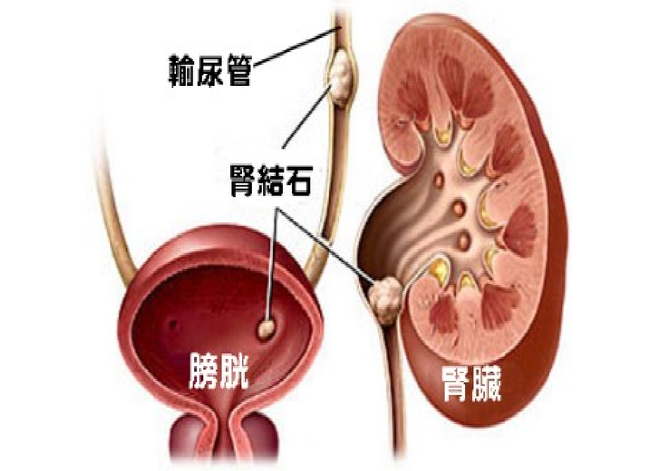 圖文圖片