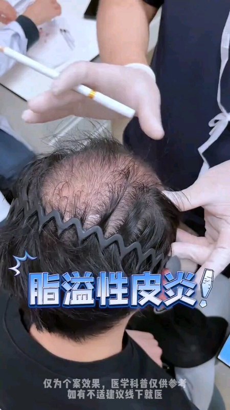 視頻封面