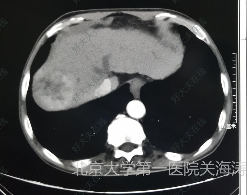 圖文圖片